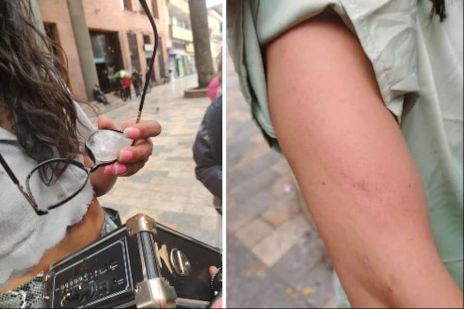 Con palos, sujetos habrían golpeado y discriminado a dos mujeres trans en el centro de Bogotá.