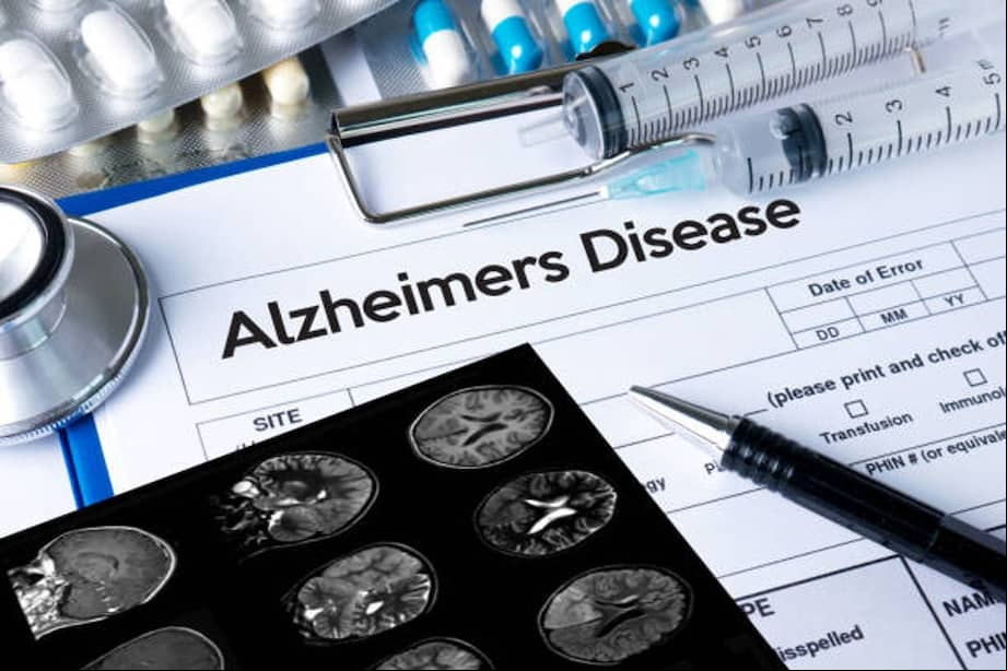 Según los resultados publicados en la revista Nature Medicine, los investigadores emplearon el biomarcador phospho-tau217 en sangre, el cual fue probado en 1.767 personas con síntomas compatibles con alzhéimer, de diversa severidad.